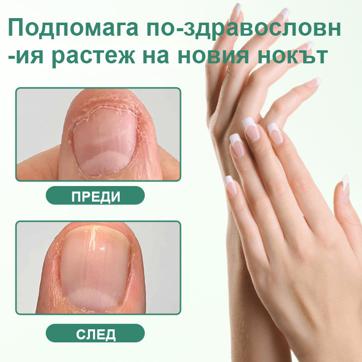 CleraNaure® Детокс серум за дълбоко проникване срещу гъбички по ноктите