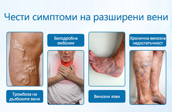 CleraNature® Билков спрей за вени