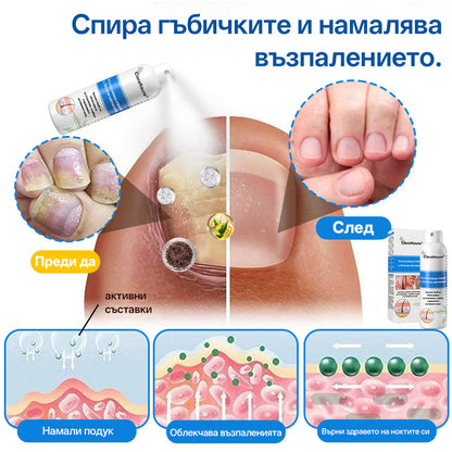 🫧CleraNature® Магнезиев спрей – Бързо облекчение за сърбяща, зачервена и чувствителна кожа (включително интимни зони)