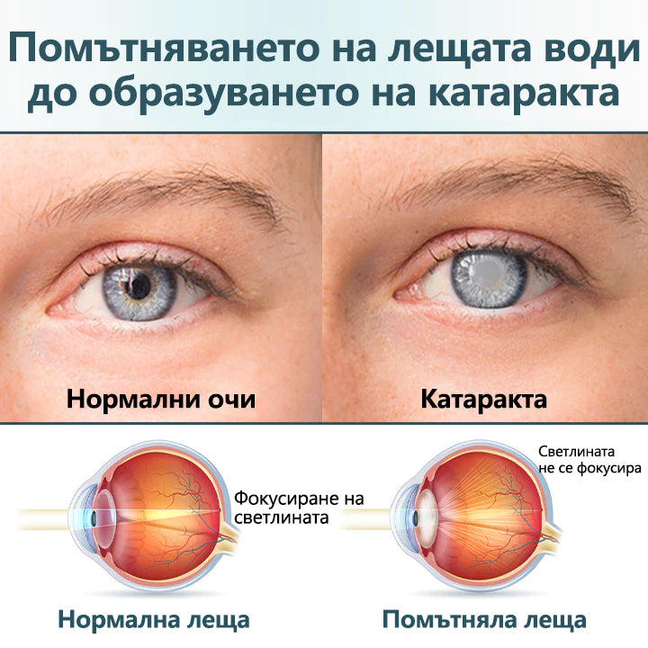 🛡️CleraNaure® Optifusion Нано капки за очи Серьум –Нанотехнологията възстановява ясното зрение, без очила, без хирургическа намеса