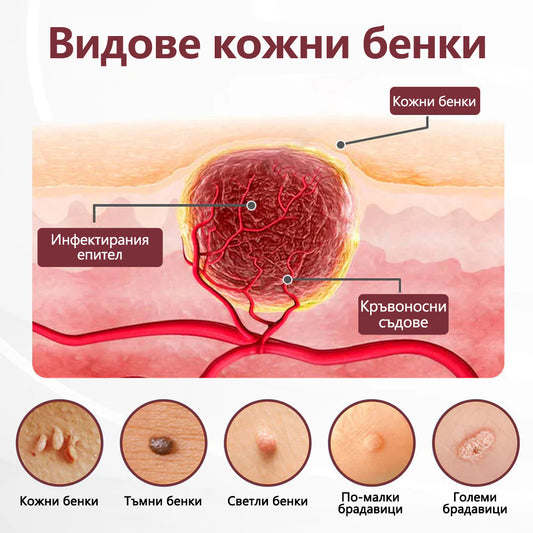 ⭐🏅 Официален магазин CleraNaure® KeraErase - Крем с двойно действие за подмладяване на кожата (Подмладяване с двойно действие – омекотява издигнатите бучки и разлага дълбокото натрупване на кератин без киселини и раздразнения)