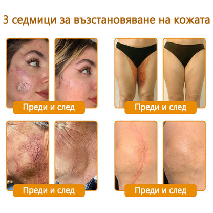 CleraNaure® Крем за възстановяване на кожата с пчелен отров