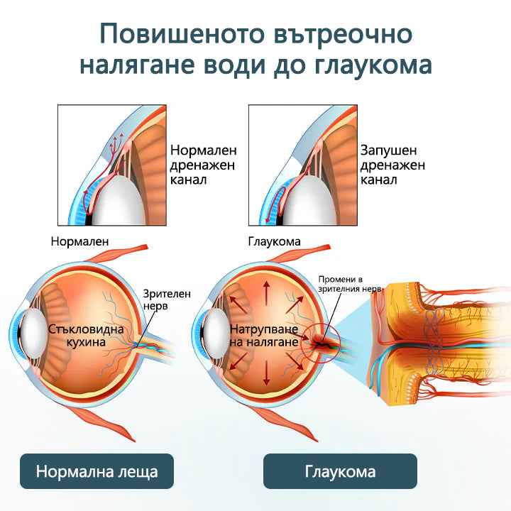 🛡️CleraNaure® Optifusion Нано капки за очи Серьум –Нанотехнологията възстановява ясното зрение, без очила, без хирургическа намеса