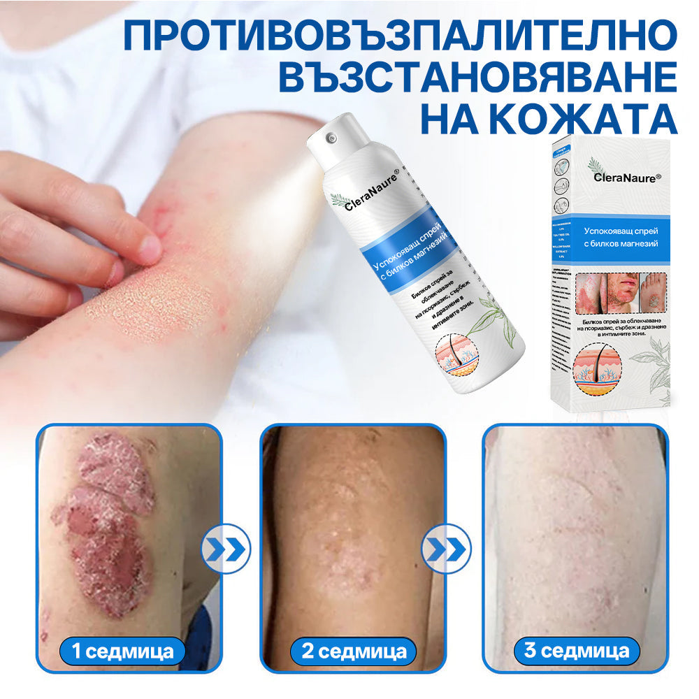 🫧CleraNature® Магнезиев спрей – Бързо облекчение за сърбяща, зачервена и чувствителна кожа (включително интимни зони)