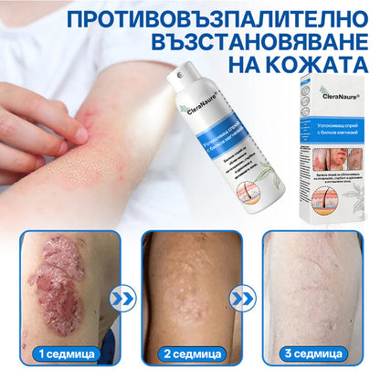 🫧CleraNature® Магнезиев спрей – Бързо облекчение за сърбяща, зачервена и чувствителна кожа (включително интимни зони)