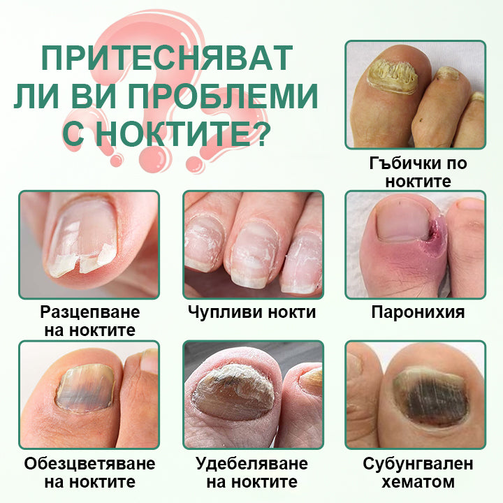 CleraNaure® Детокс серум за дълбоко проникване срещу гъбички по ноктите