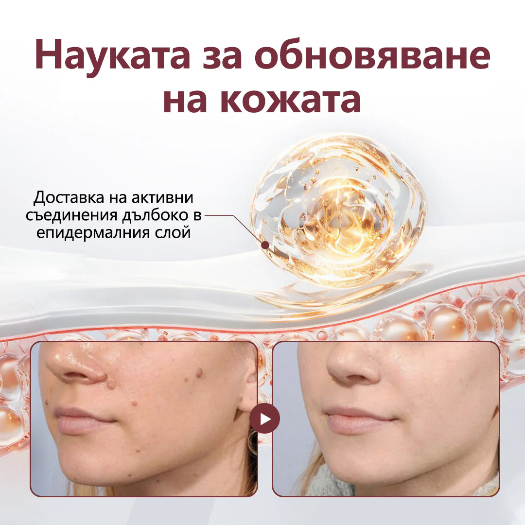 ⭐🏅 Официален магазин CleraNaure® KeraErase - Крем с двойно действие за подмладяване на кожата (Подмладяване с двойно действие – омекотява издигнатите бучки и разлага дълбокото натрупване на кератин без киселини и раздразнения)